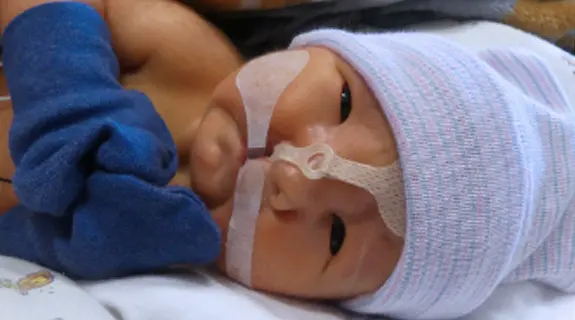 Close up of baby in NICU at Riley Hospital.